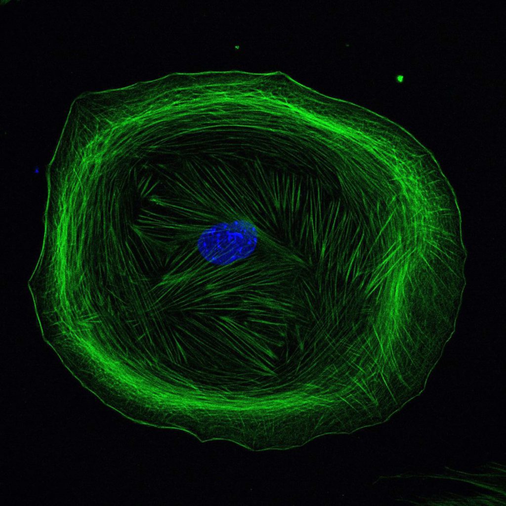 Mesenchymal cell stained with DAPI and anti-α smooth muscle actin
