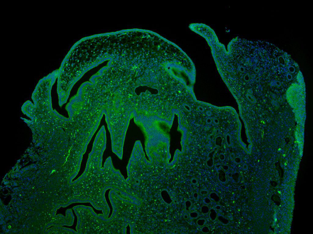 Thumbs up! – Immunofluorescent staining of a murine uterus reveals a tiny monster