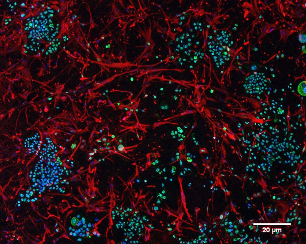 JIMT-1 breast cancer cells and human dermal fibroblasts