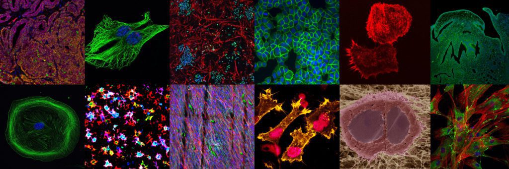 EACR Image of the Month winners