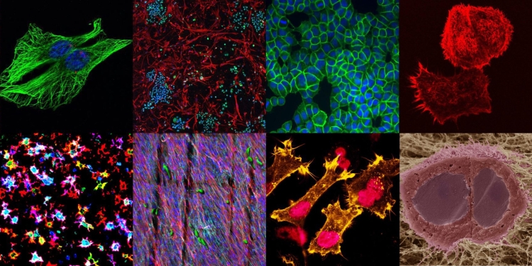 EACR Image of the Month winners