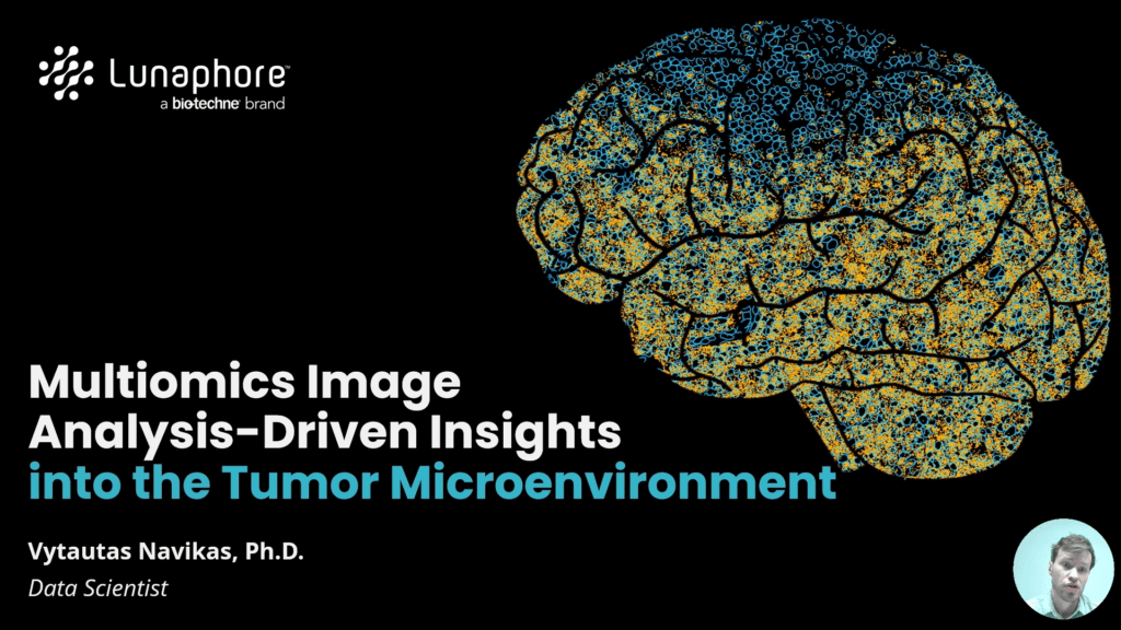 VIDEO | Multiomics Image Analysis-Driven Insights into Tumor Microenvironment