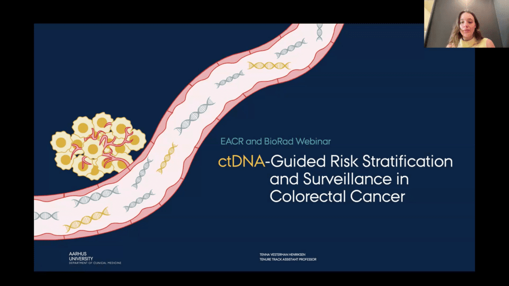 VIDEO | ctDNA-Guided Risk Stratification and Surveillance in Colorectal Cancer