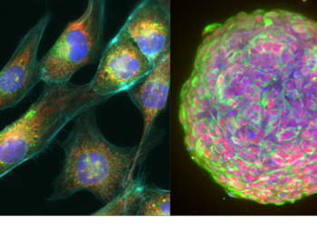 GBM cell painting / GBM E13 spheroid