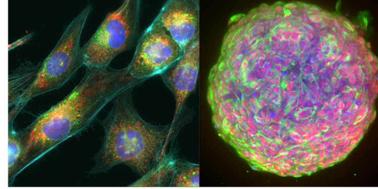 GBM cell painting / GBM E13 spheroid